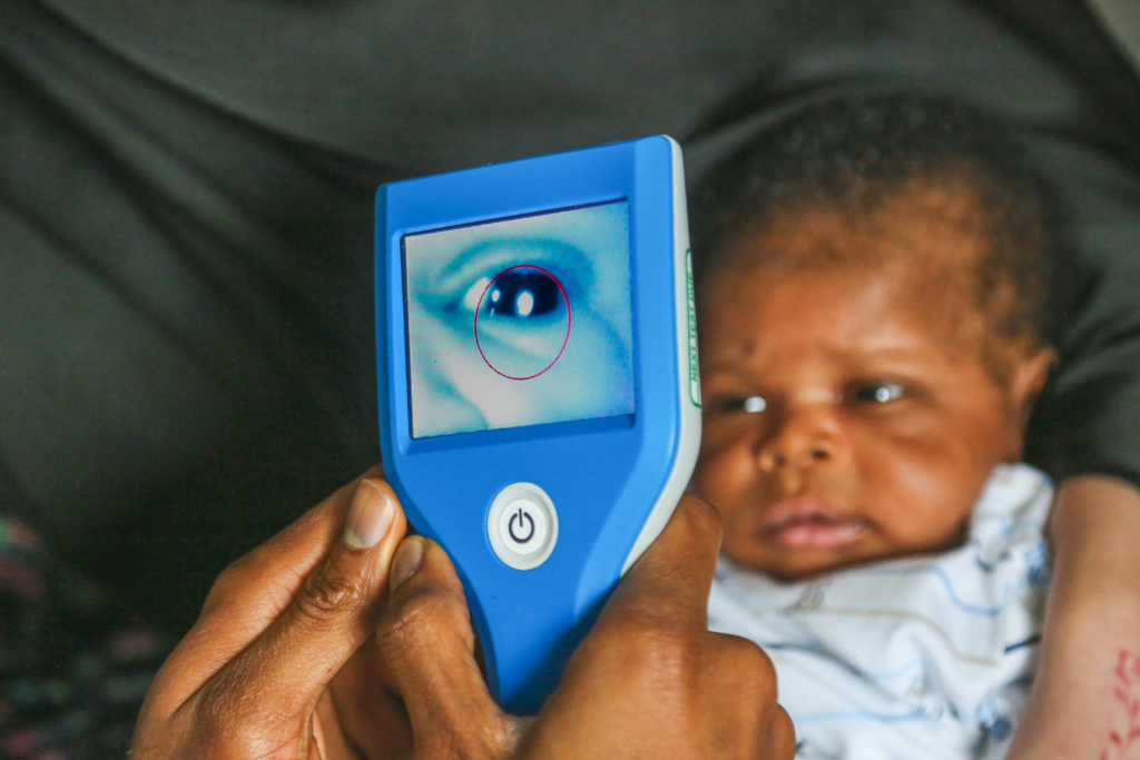 Newborn eye screening